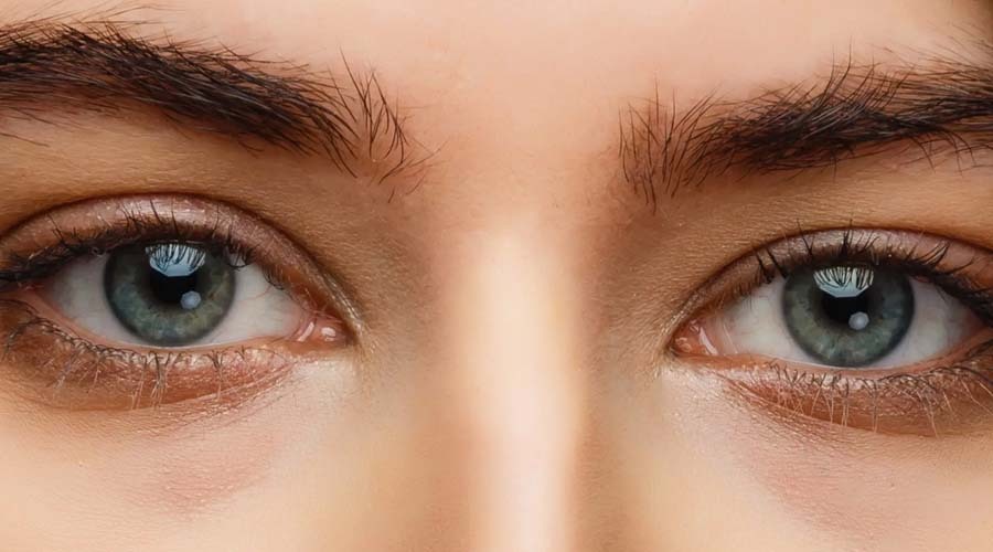 Relief for Itchy, Scaly, Dry Eyes - A Natural Approach