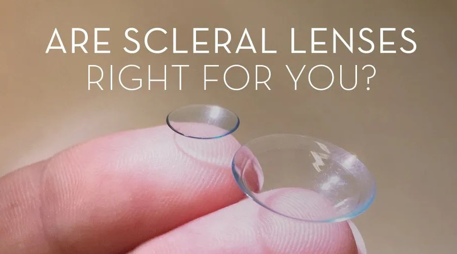 Scleral Lenses - What's the craze about?